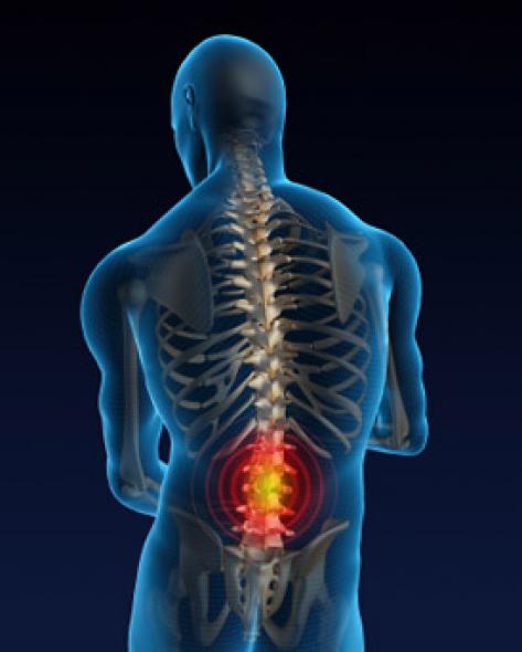 Back Pain Symptoms