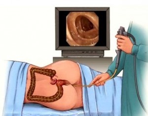 Irritable Bowel Syndrome Diagnosis