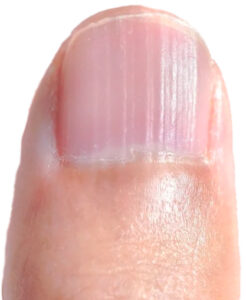 Ridged Nails